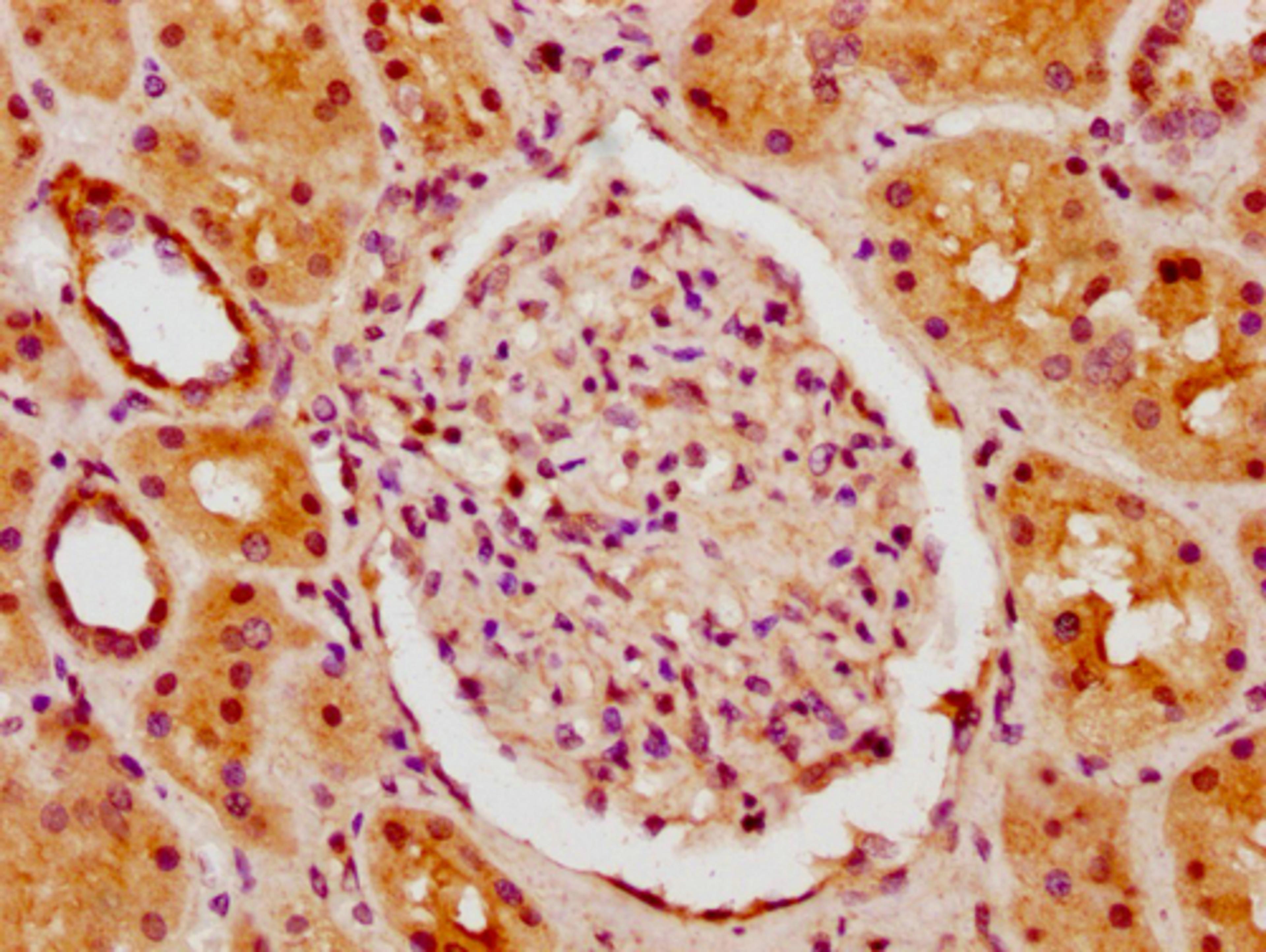 IHC image of CSB-PA010378PA62nhibHU diluted at 1:10 and staining in paraffin-embedded human kidney tissue performed on a Leica BondTM system. After dewaxing and hydration, antigen retrieval was mediated by high pressure in a citrate buffer (pH 6.0). Section was blocked with 10% normal goat serum 30min at RT. Then primary antibody (1% BSA) was incubated at 4°C overnight. The primary is detected by a biotinylated secondary antibody and visualized using an HRP conjugated SP system.