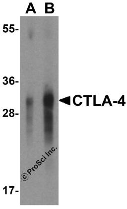 Western blot analysis of CTLA-4 in overexpressing HEK293 cells CTLA-4 antibody at 0.5 and 1 &#956;g/mL.