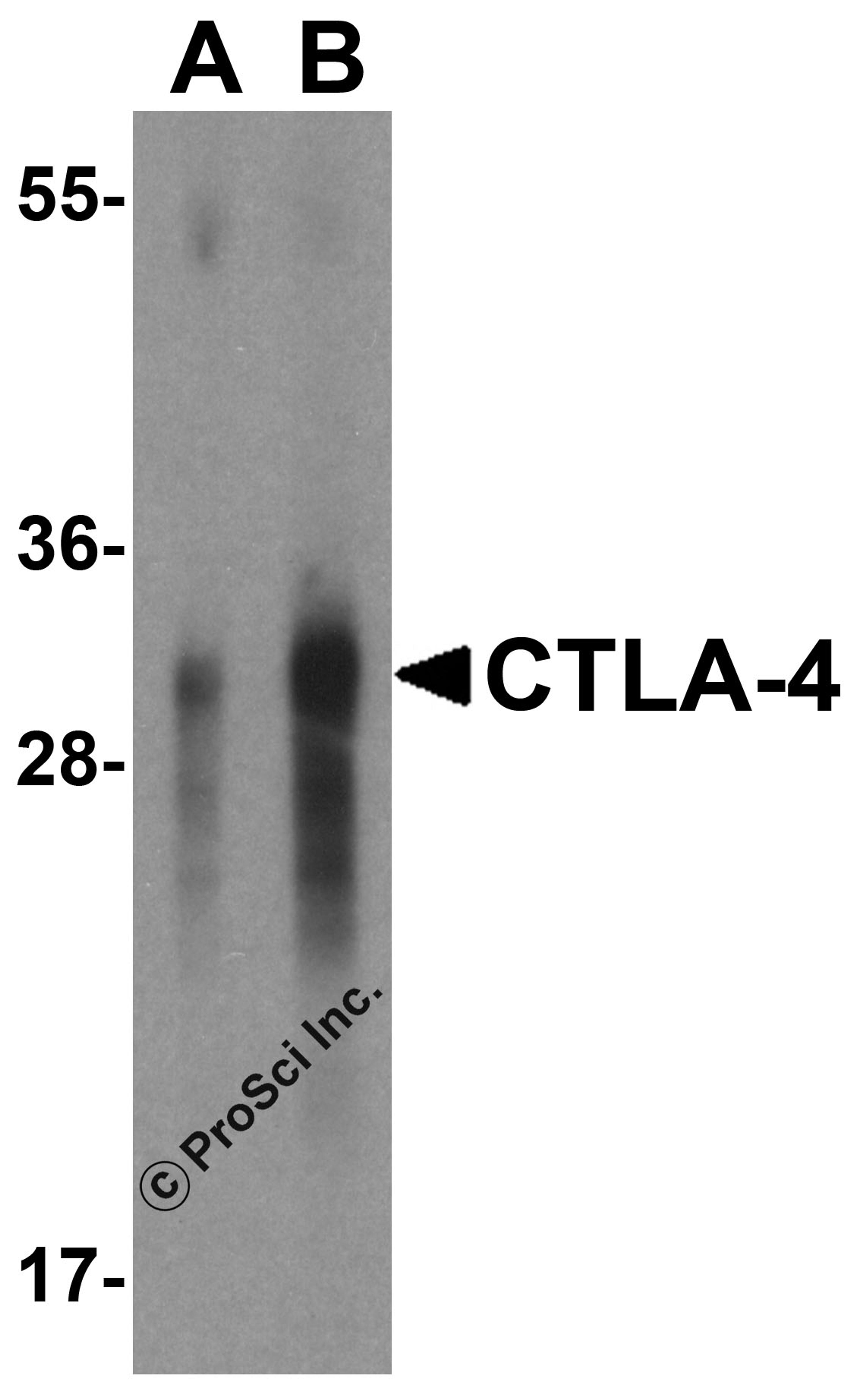 Western blot analysis of CTLA-4 in overexpressing HEK293 cells CTLA-4 antibody at 0.5 and 1 μg/mL.
