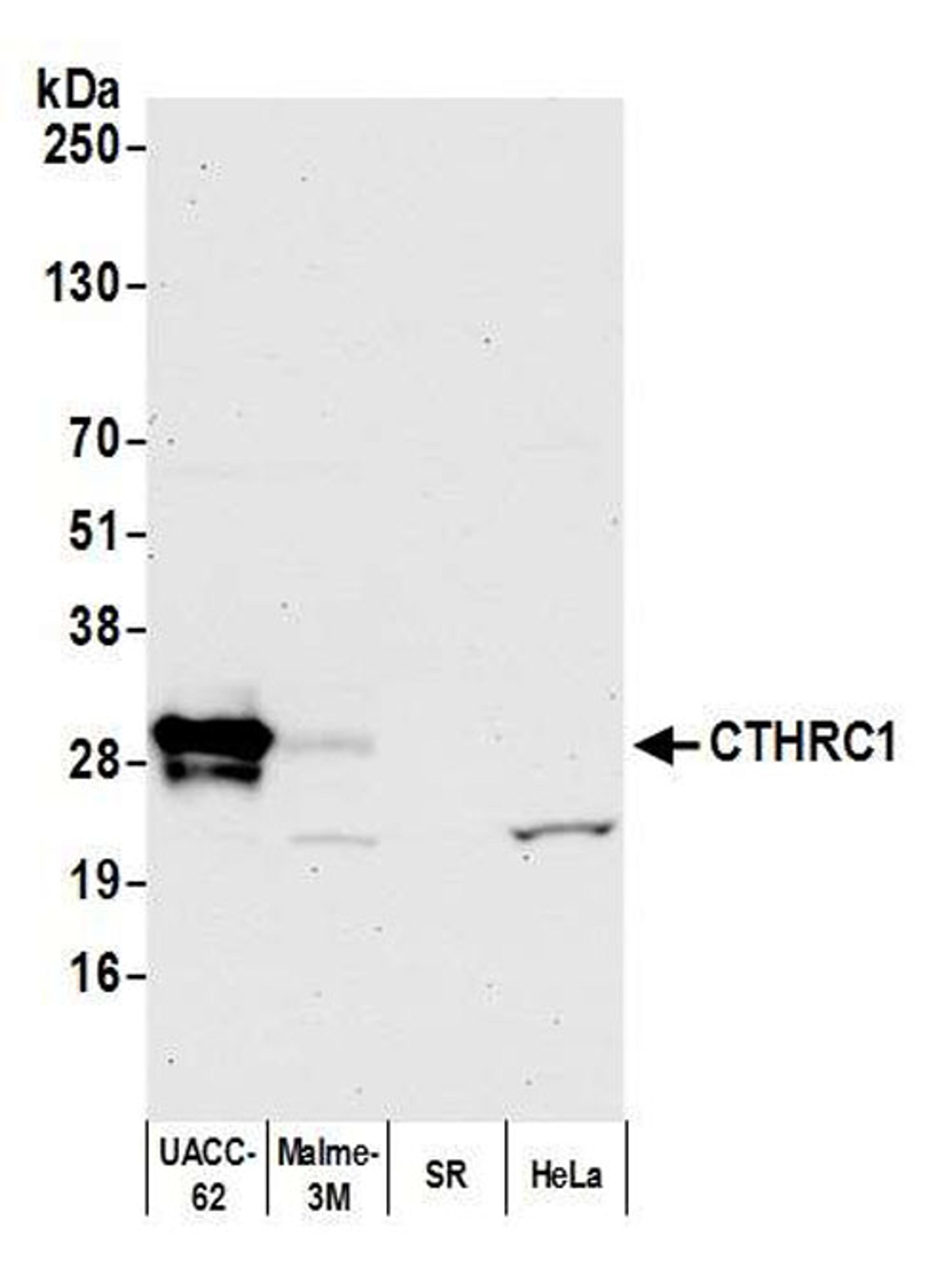 Detection of human CTHRC1 by WB.