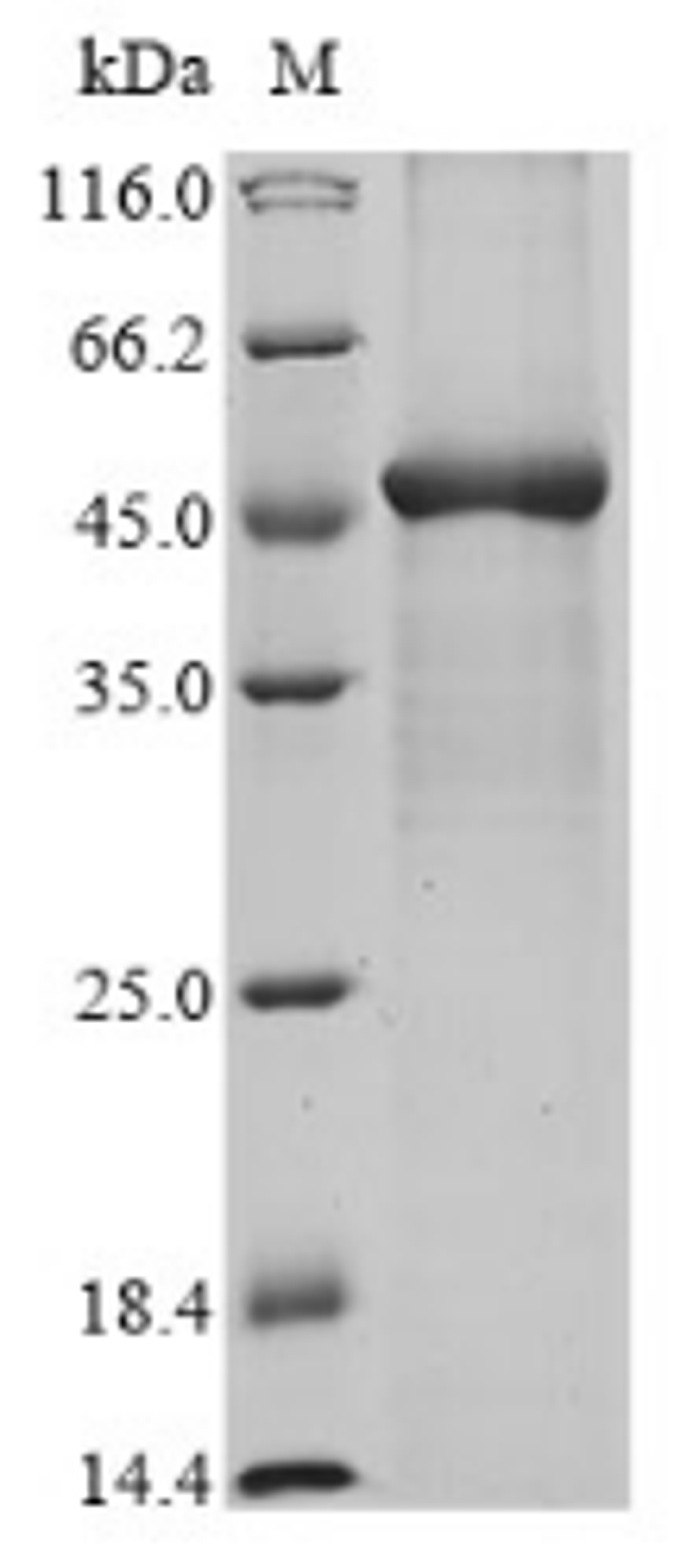 (Tris-Glycine gel) Discontinuous SDS-PAGE (reduced) with 5% enrichment gel and 15% separation gel.