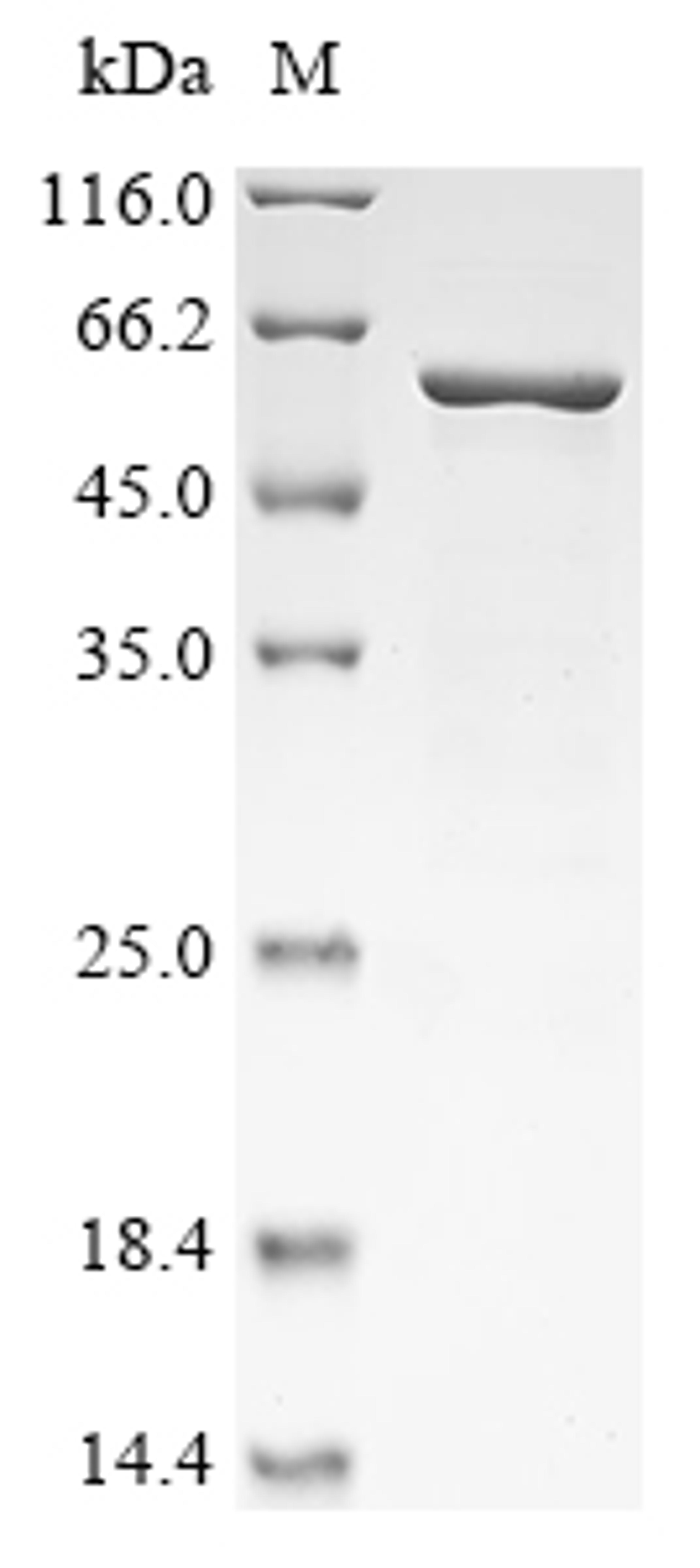 (Tris-Glycine gel) Discontinuous SDS-PAGE (reduced) with 5% enrichment gel and 15% separation gel.