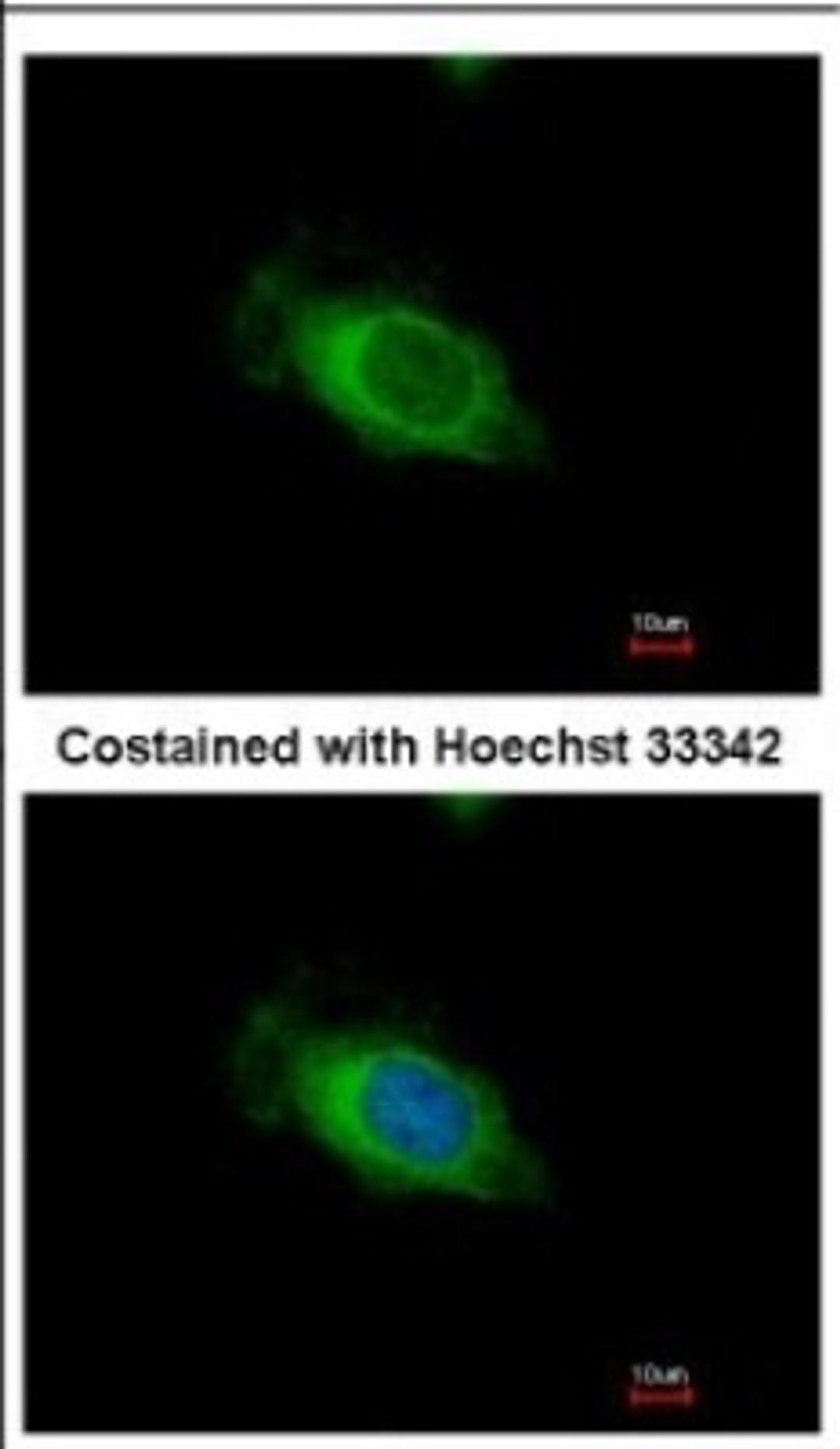 Immunocytochemistry/Immunofluorescence: Nardilysin Antibody [NBP2-19473] - Immunofluorescence analysis of methanol-fixed HeLa, using antibody at 1:500 dilution.