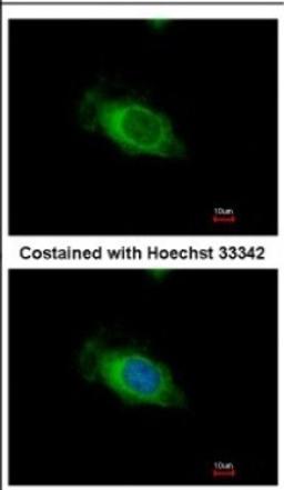 Immunocytochemistry/Immunofluorescence: Nardilysin Antibody [NBP2-19473] - Immunofluorescence analysis of methanol-fixed HeLa, using antibody at 1:500 dilution.