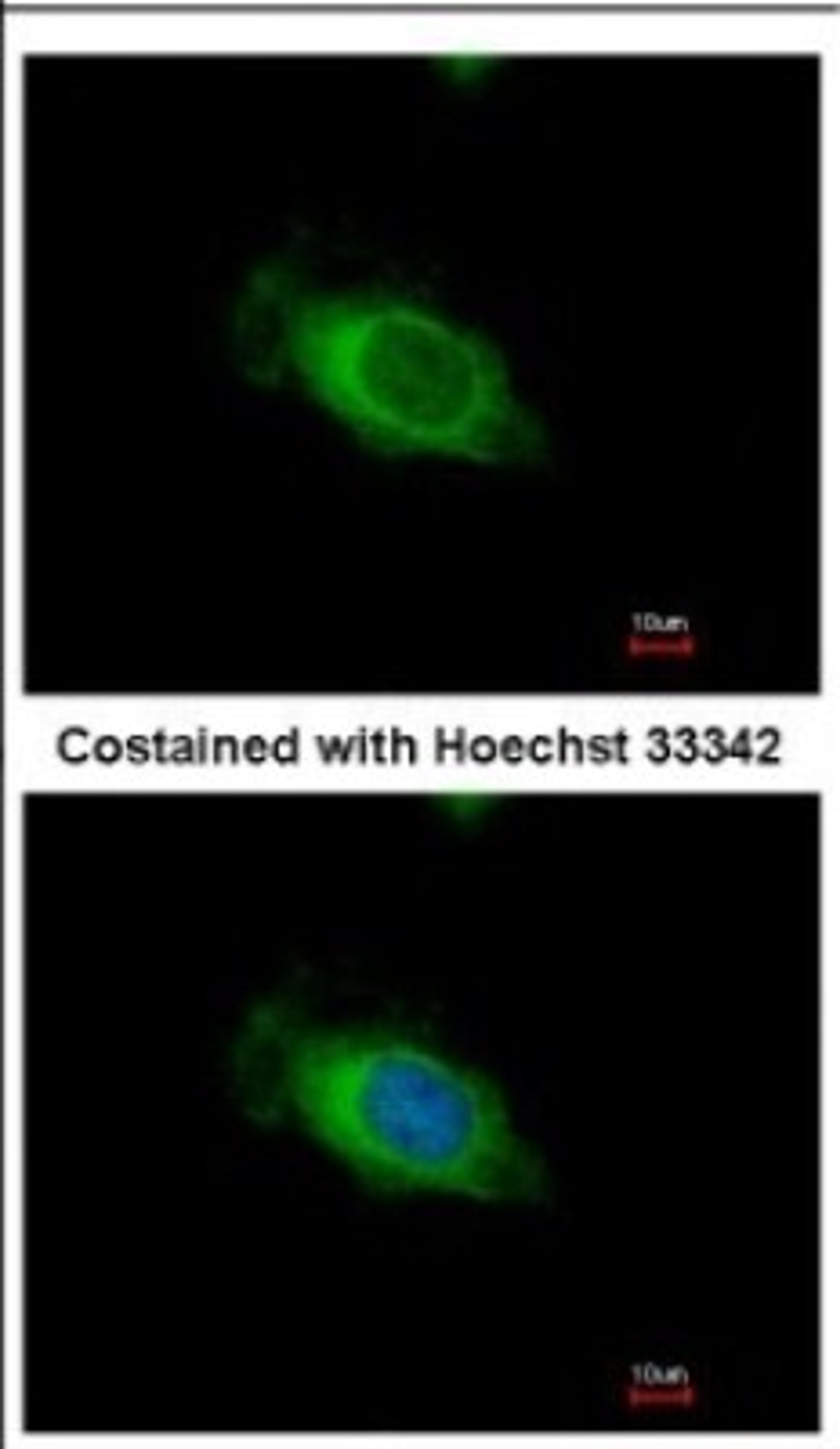 Immunocytochemistry/Immunofluorescence: Nardilysin Antibody [NBP2-19473] - Immunofluorescence analysis of methanol-fixed HeLa, using antibody at 1:500 dilution.