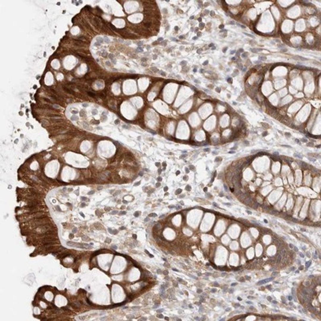 Immunohistochemistry-Paraffin: Claudin-12 Antibody [NBP1-87450] - Staining of human rectum shows strong positivity in glandular cells.