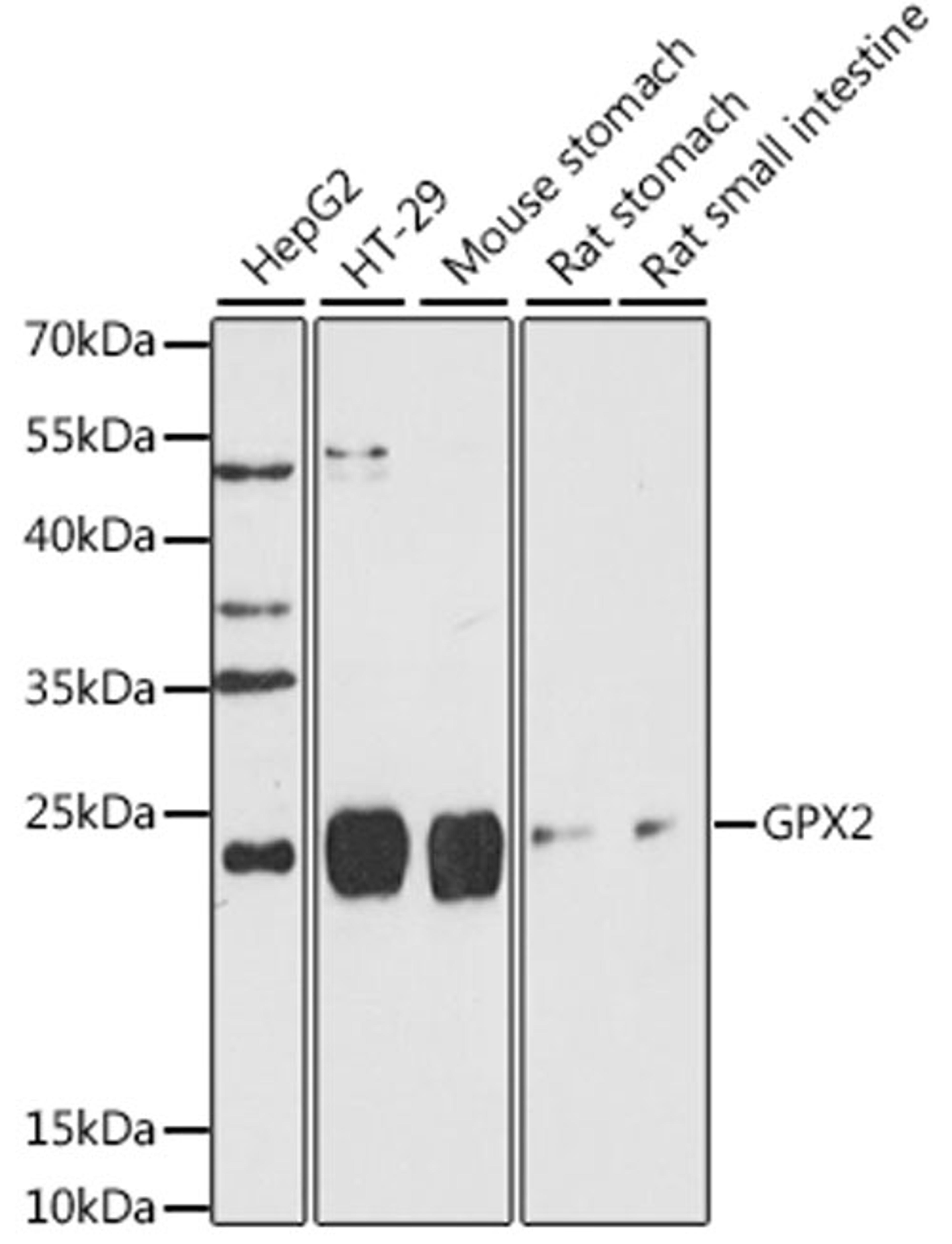 Western blot - GPX2 antibody (A15999)