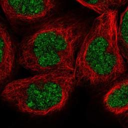 Immunocytochemistry/Immunofluorescence: DTHD1 Antibody [NBP1-93994] - Staining of human cell line A-431 shows positivity in nucleus.