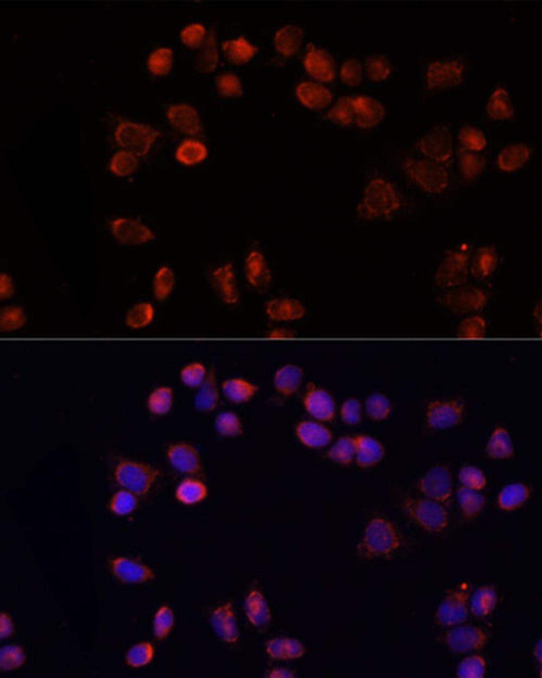 Immunofluorescence - SLC25A4 antibody (A15027)