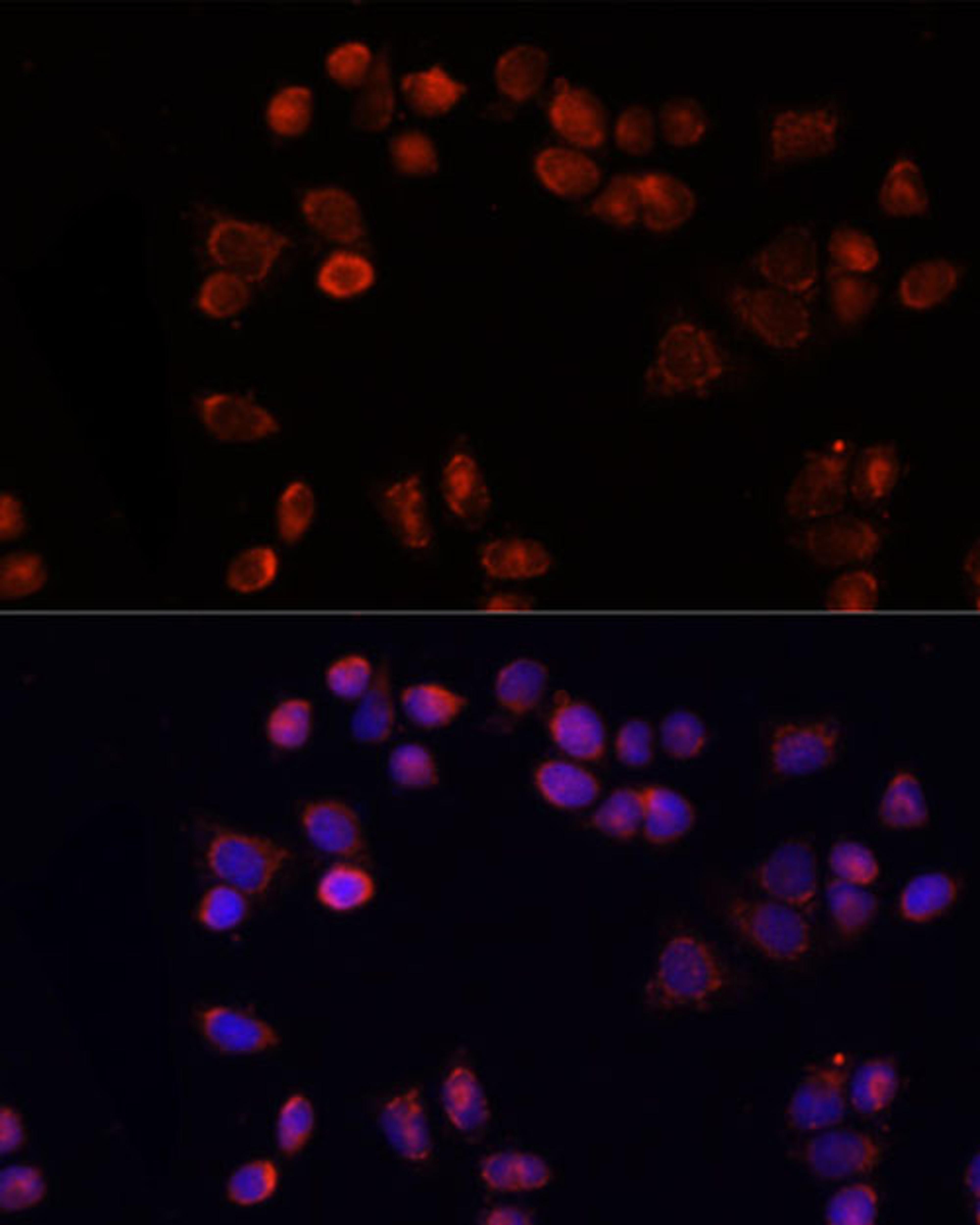 Immunofluorescence - SLC25A4 antibody (A15027)