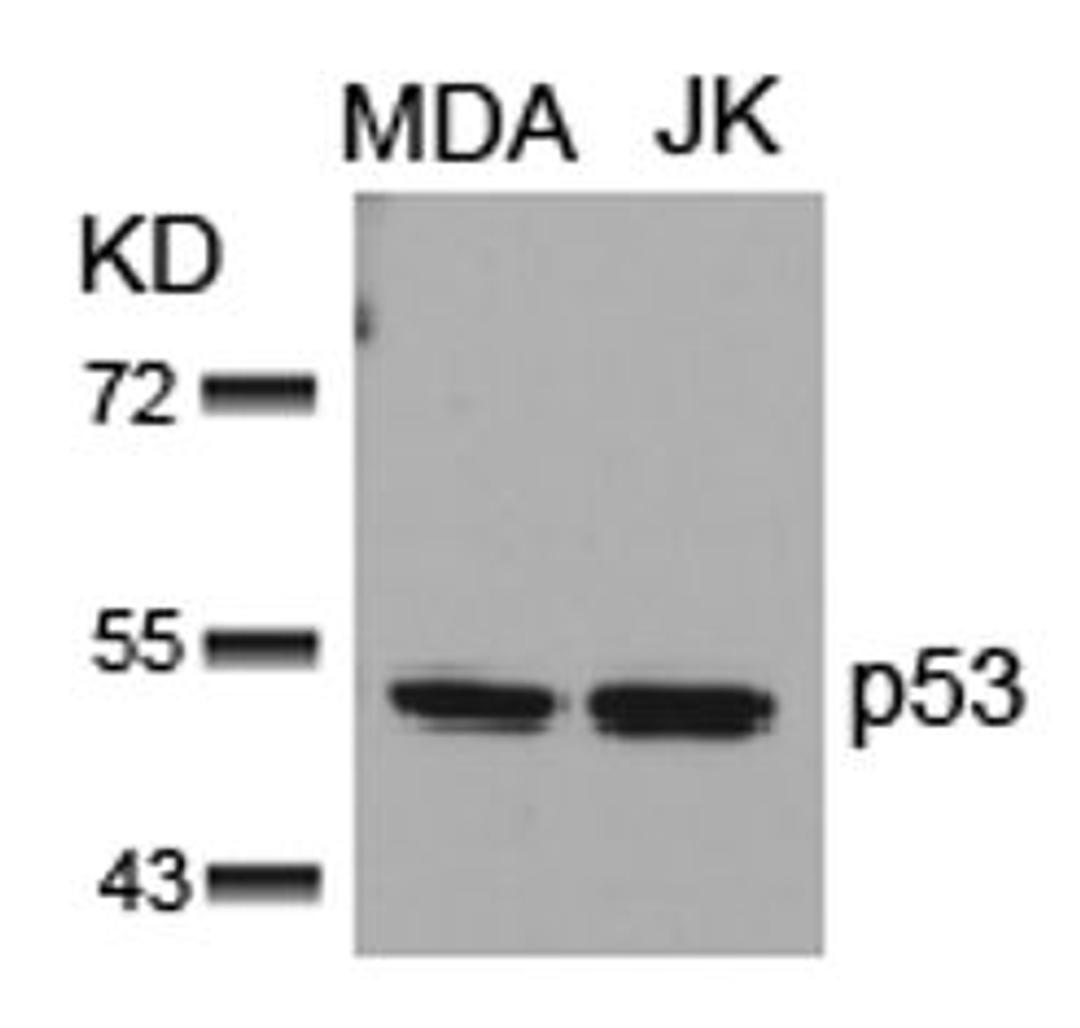 Western blot analysis of lysed extracts from MDA and JK cells using p53 (Ab-15).