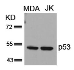 Western blot analysis of lysed extracts from MDA and JK cells using p53 (Ab-15).