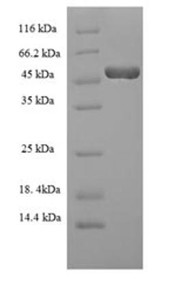 (Tris-Glycine gel) Discontinuous SDS-PAGE (reduced) with 5% enrichment gel and 15% separation gel.