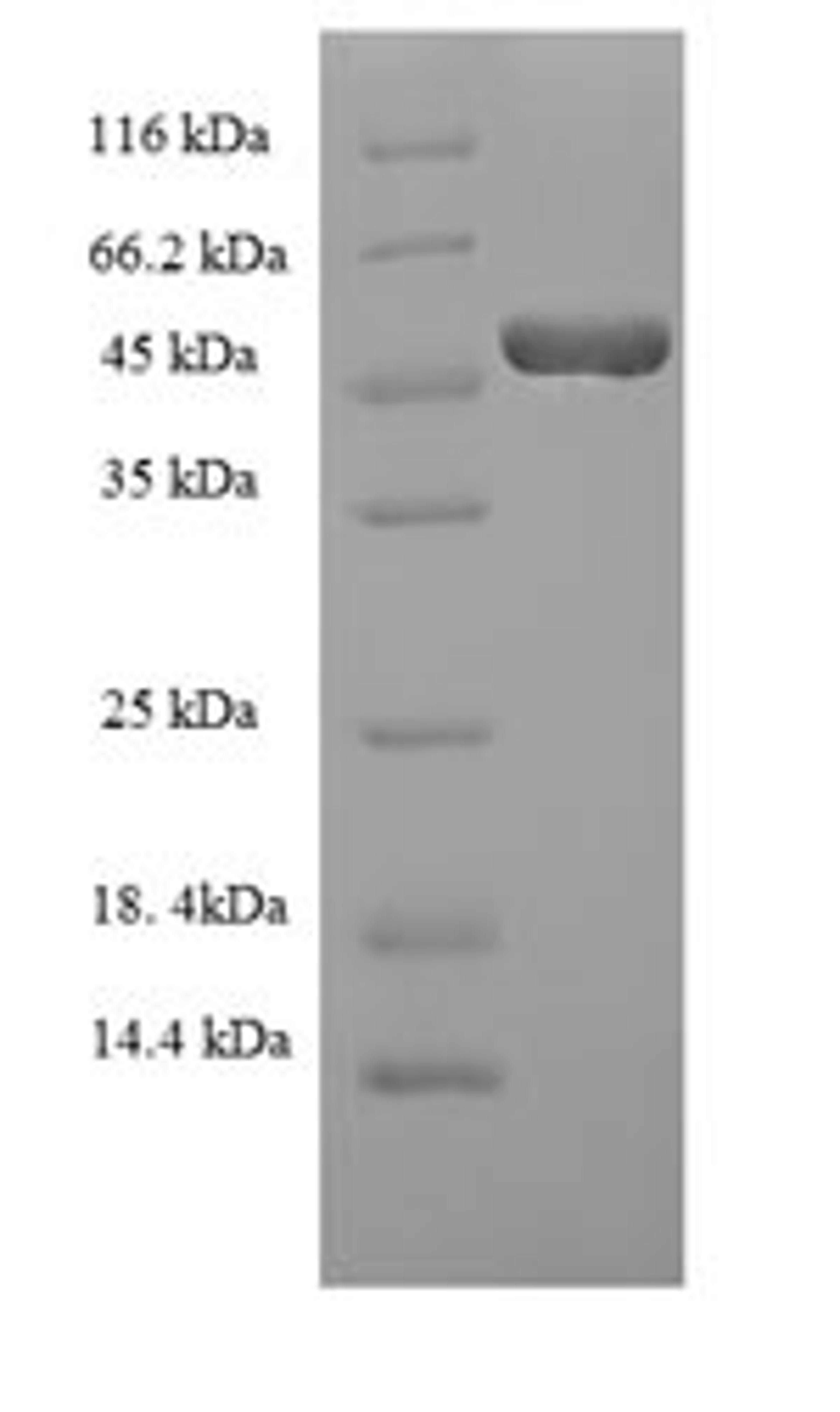 (Tris-Glycine gel) Discontinuous SDS-PAGE (reduced) with 5% enrichment gel and 15% separation gel.