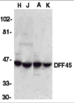 Western blot analysis of DFF45 in HeLa (H), Jurkat (J), A431 (A), and K562 (K) whole cell lysate with DFF45 antibody at 1:1000 dilution.