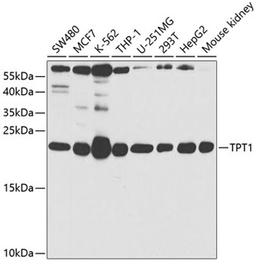 Western blot - TPT1 antibody (A5442)