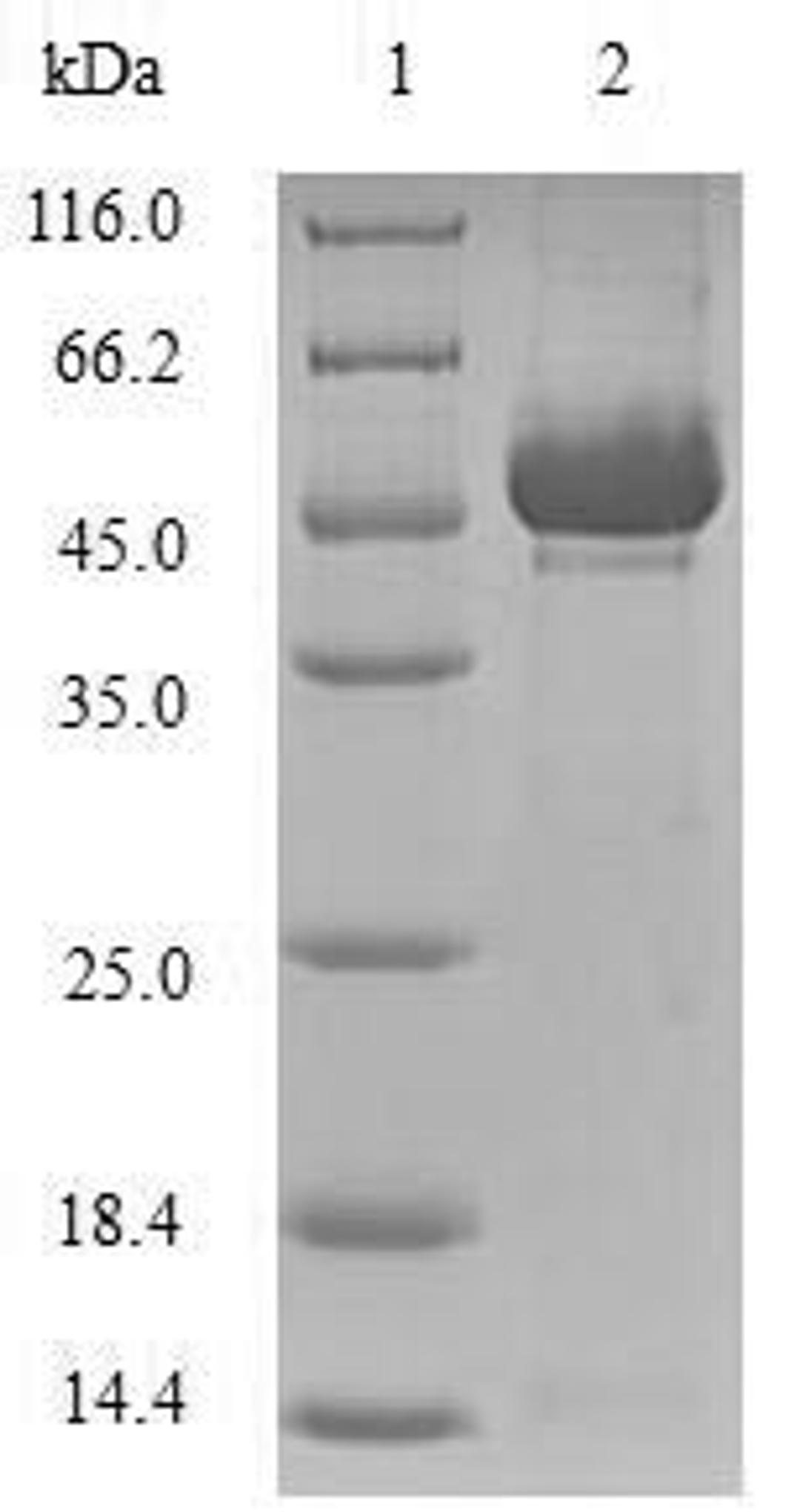 (Tris-Glycine gel) Discontinuous SDS-PAGE (reduced) with 5% enrichment gel and 15% separation gel.