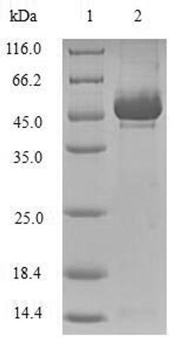 (Tris-Glycine gel) Discontinuous SDS-PAGE (reduced) with 5% enrichment gel and 15% separation gel.
