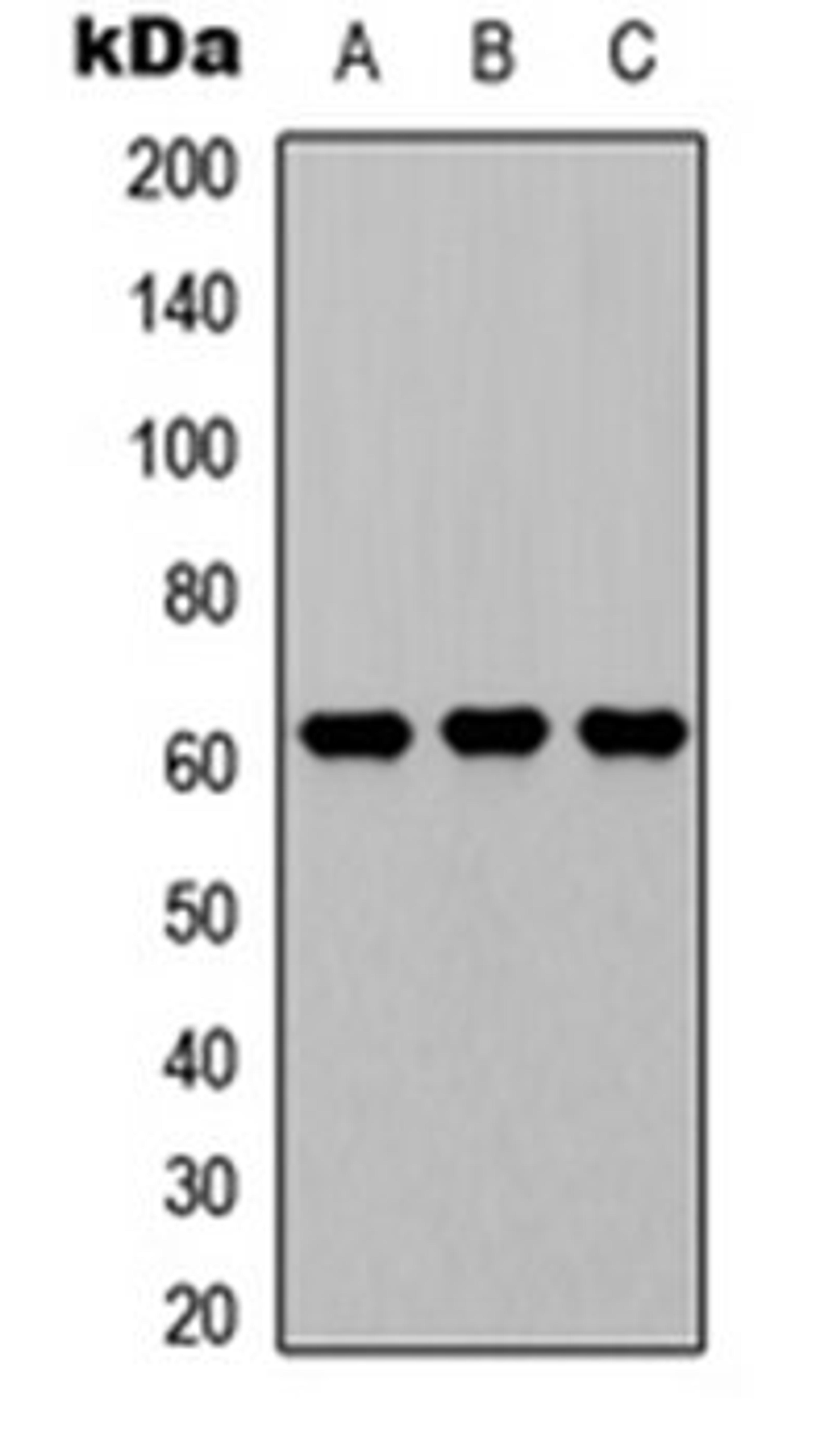 Western blot analysis of A549 (Lane 1), NS-1 (Lane 2), PC12 (Lane 3) whole cell lysates using CD224 LC antibody