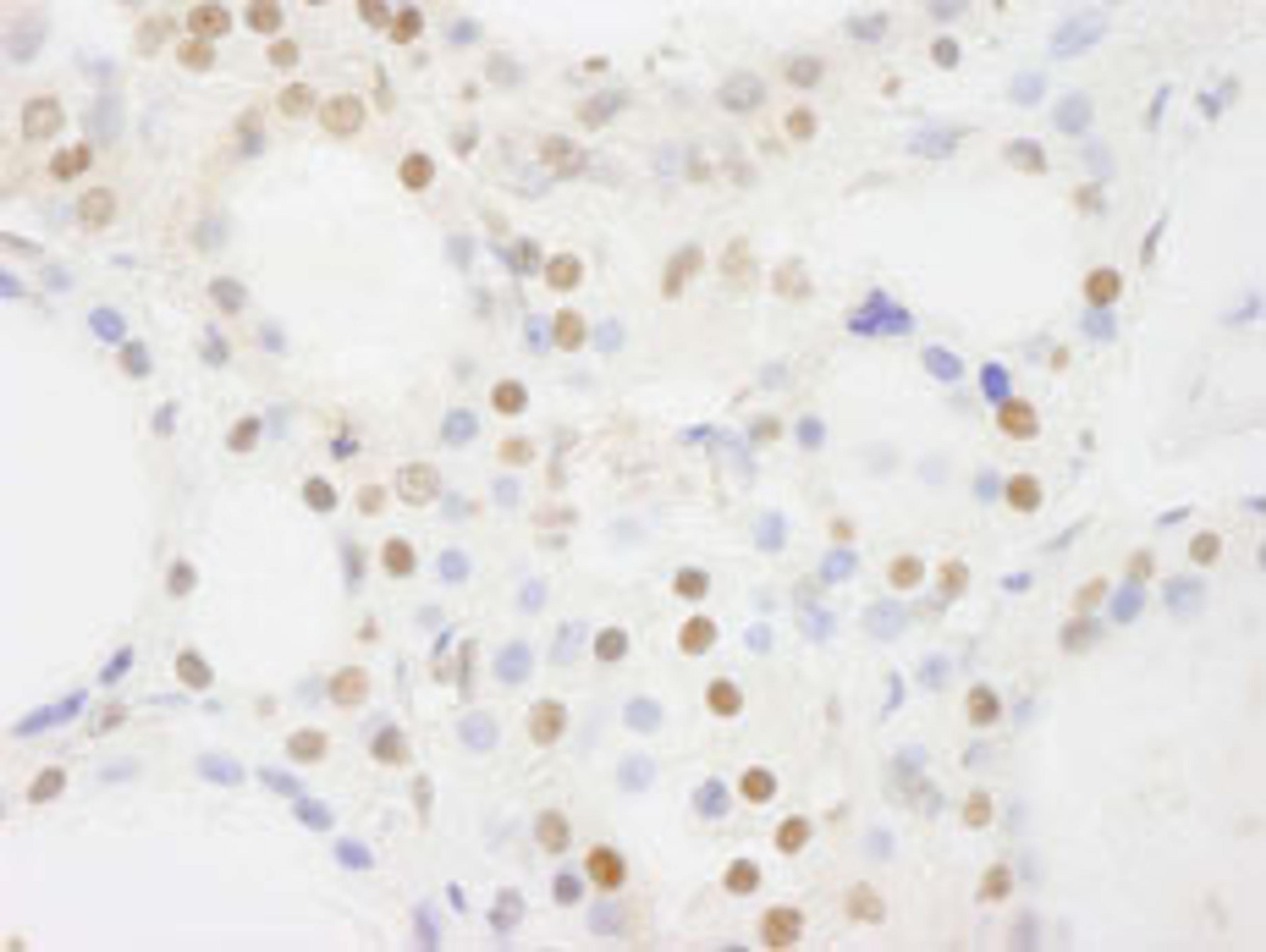 Detection of human BRF1 by immunohistochemistry.