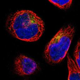 Immunocytochemistry/Immunofluorescence: IFITM1 Antibody [NBP1-89345] - Staining of human cell line A-431 shows positivity in cytoplasm.