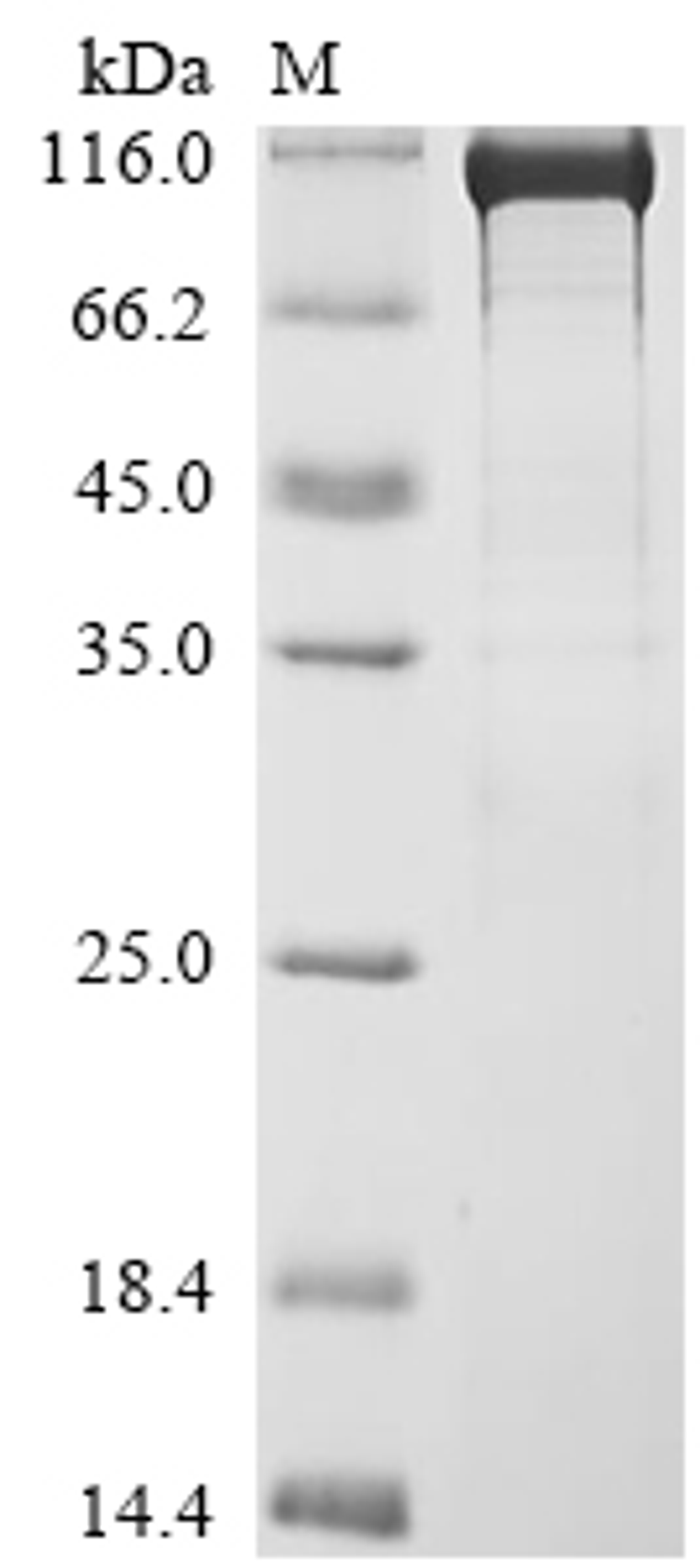 (Tris-Glycine gel) Discontinuous SDS-PAGE (reduced) with 5% enrichment gel and 15% separation gel.