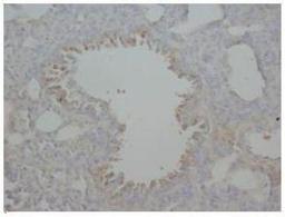 Immunohistochemistry-Paraffin: AGER Antibody [NBP1-42612] - Immunohistochemical analysis of paraffin-embedded Rat Tissue sections (lung), using AGER antibody.