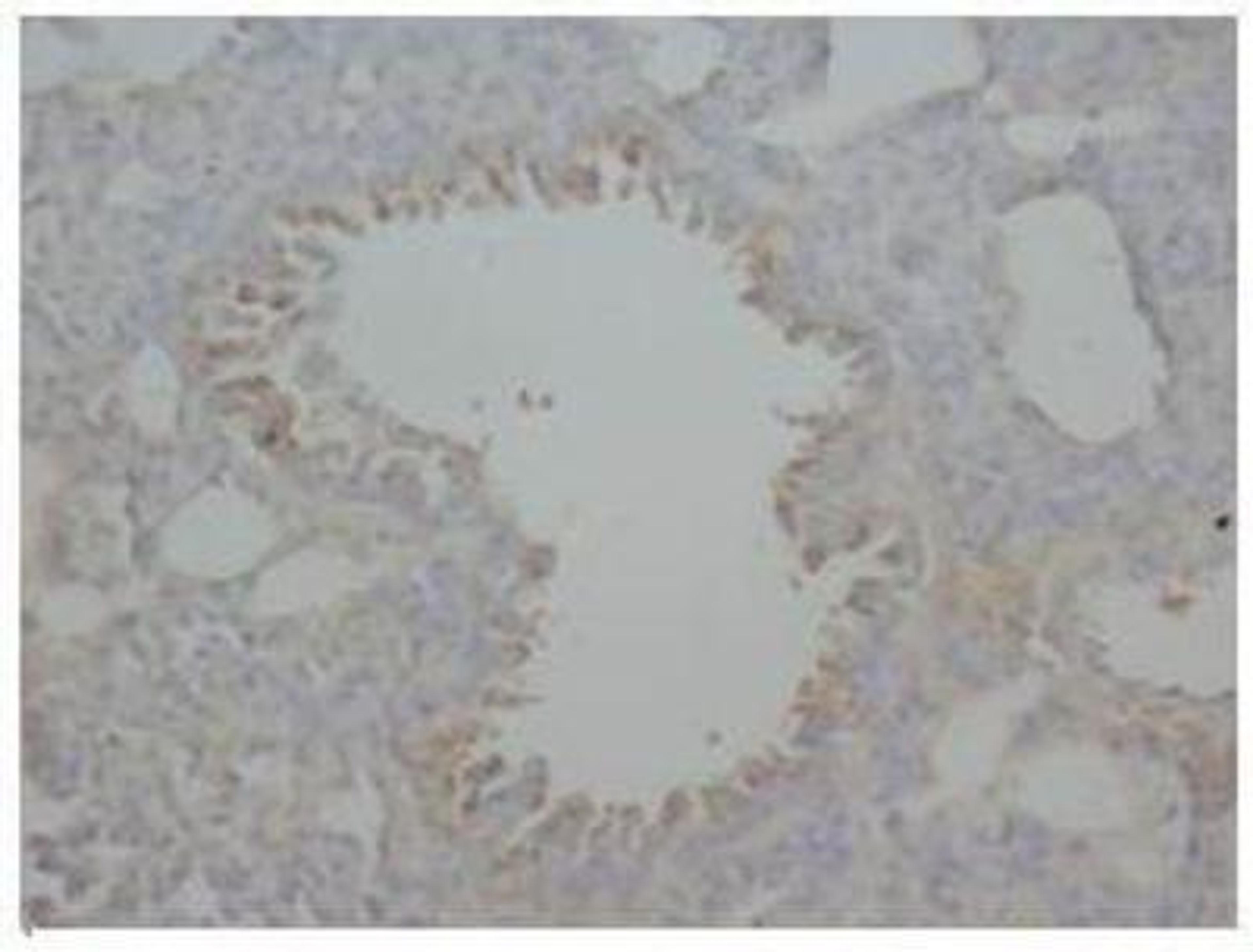 Immunohistochemistry-Paraffin: AGER Antibody [NBP1-42612] - Immunohistochemical analysis of paraffin-embedded Rat Tissue sections (lung), using AGER antibody.