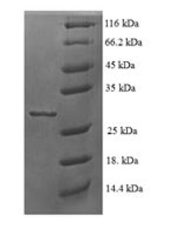 (Tris-Glycine gel) Discontinuous SDS-PAGE (reduced) with 5% enrichment gel and 15% separation gel.