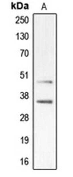 Western blot analysis of Jurkat (Lane 1) whole cell lysates using CDK10 antibody