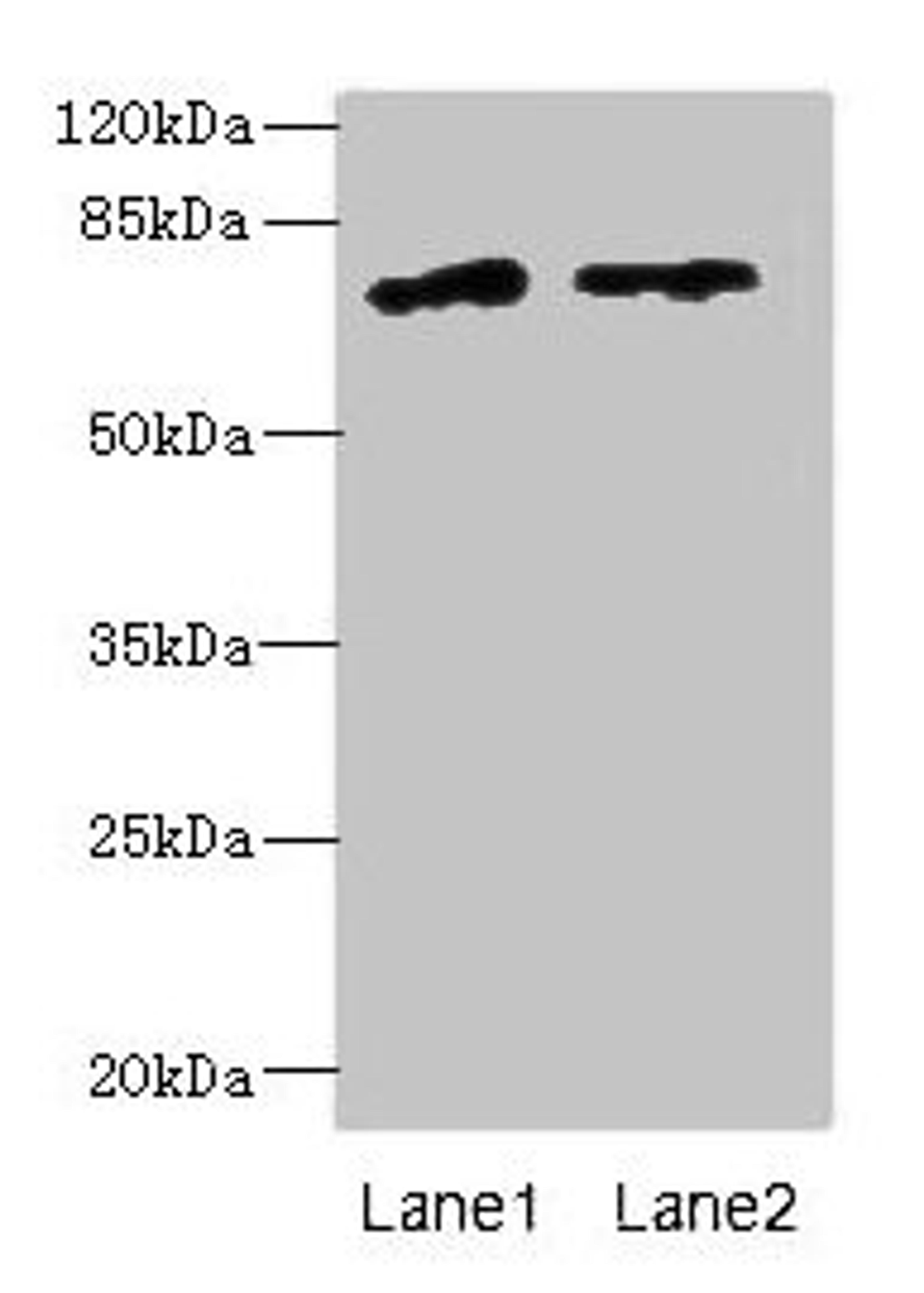 Western blot. All lanes: ENOX1 antibody at 5µg/ml. Lane 1: Jurkat whole cell lysate. Lane 2: Raji whole cell lysate. Secondary. Goat polyclonal to rabbit IgG at 1/10000 dilution. Predicted band size: 74, 28 kDa. Observed band size: 74 kDa