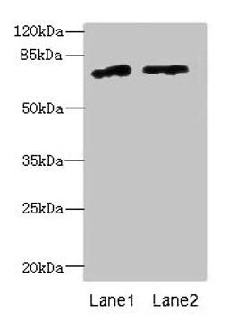 Western blot. All lanes: ENOX1 antibody at 5µg/ml. Lane 1: Jurkat whole cell lysate. Lane 2: Raji whole cell lysate. Secondary. Goat polyclonal to rabbit IgG at 1/10000 dilution. Predicted band size: 74, 28 kDa. Observed band size: 74 kDa