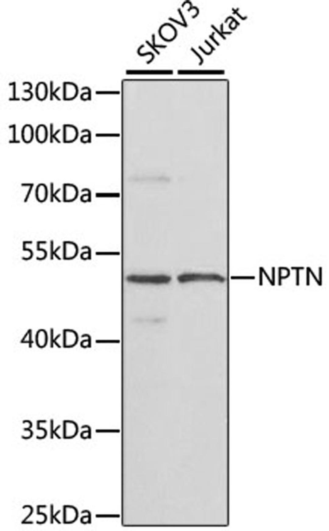 Western blot - NPTN antibody (A7972)