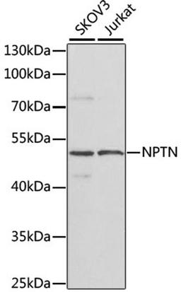 Western blot - NPTN antibody (A7972)