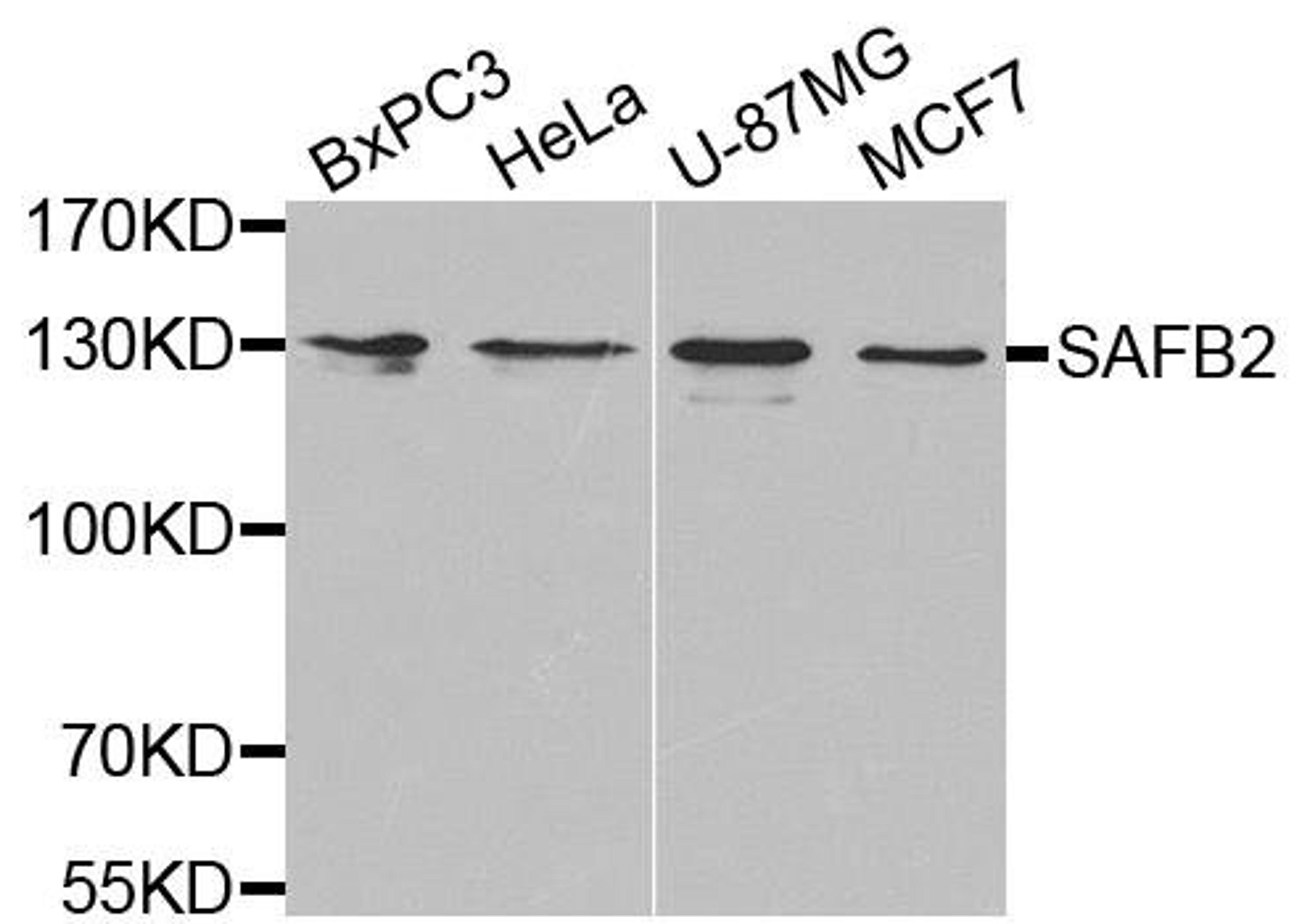 Western blot analysis of extracts of various cell lines using SAFB2 antibody