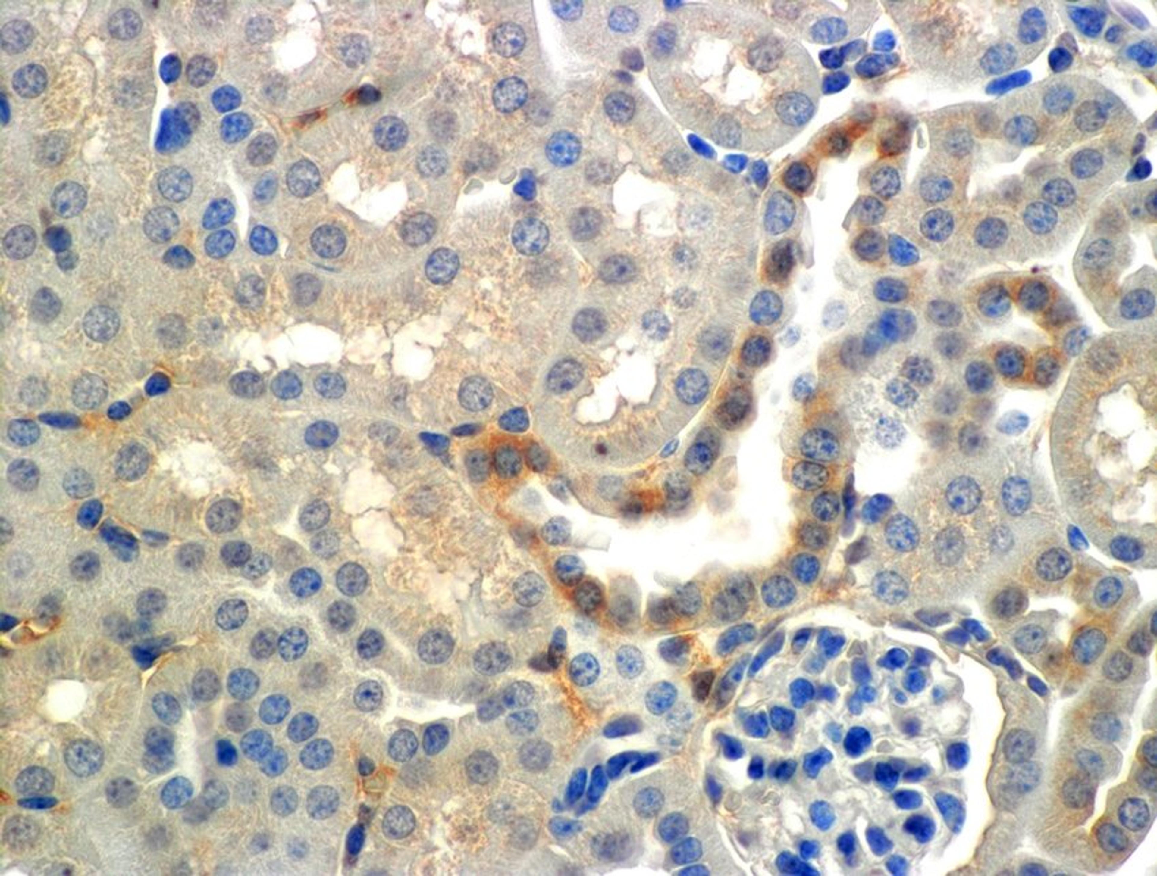 Immunohistochemical staining of mouse Kidney (cortex) tissue using ENaC beta antibody