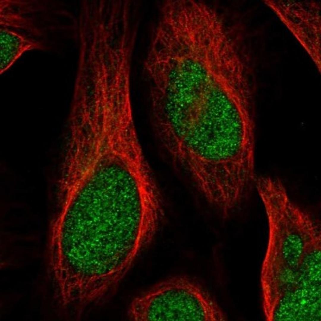 Immunocytochemistry/Immunofluorescence: FAM212B Antibody [NBP1-93887] - Staining of human cell line U-2 OS shows positivity in nucleus.