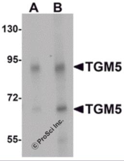 Western blot analysis of TGM5 in rat heart tissue lysate with TGM5 antibody at (A) 1 and (B) 2 &#956;g/mL.