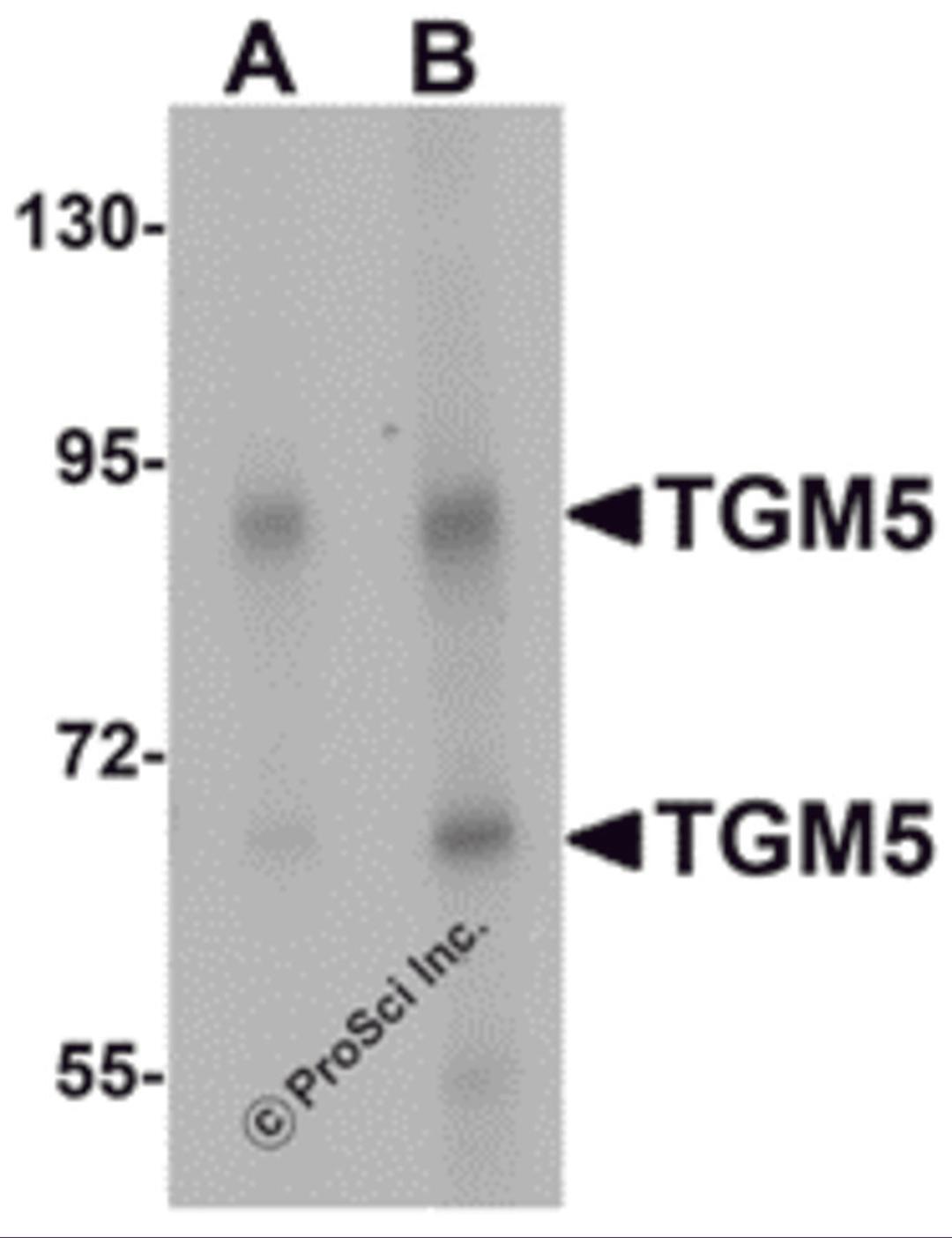 Western blot analysis of TGM5 in rat heart tissue lysate with TGM5 antibody at (A) 1 and (B) 2 μg/mL.
