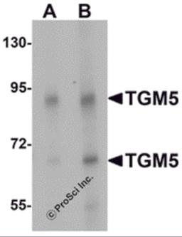 Western blot analysis of TGM5 in rat heart tissue lysate with TGM5 antibody at (A) 1 and (B) 2 μg/mL.