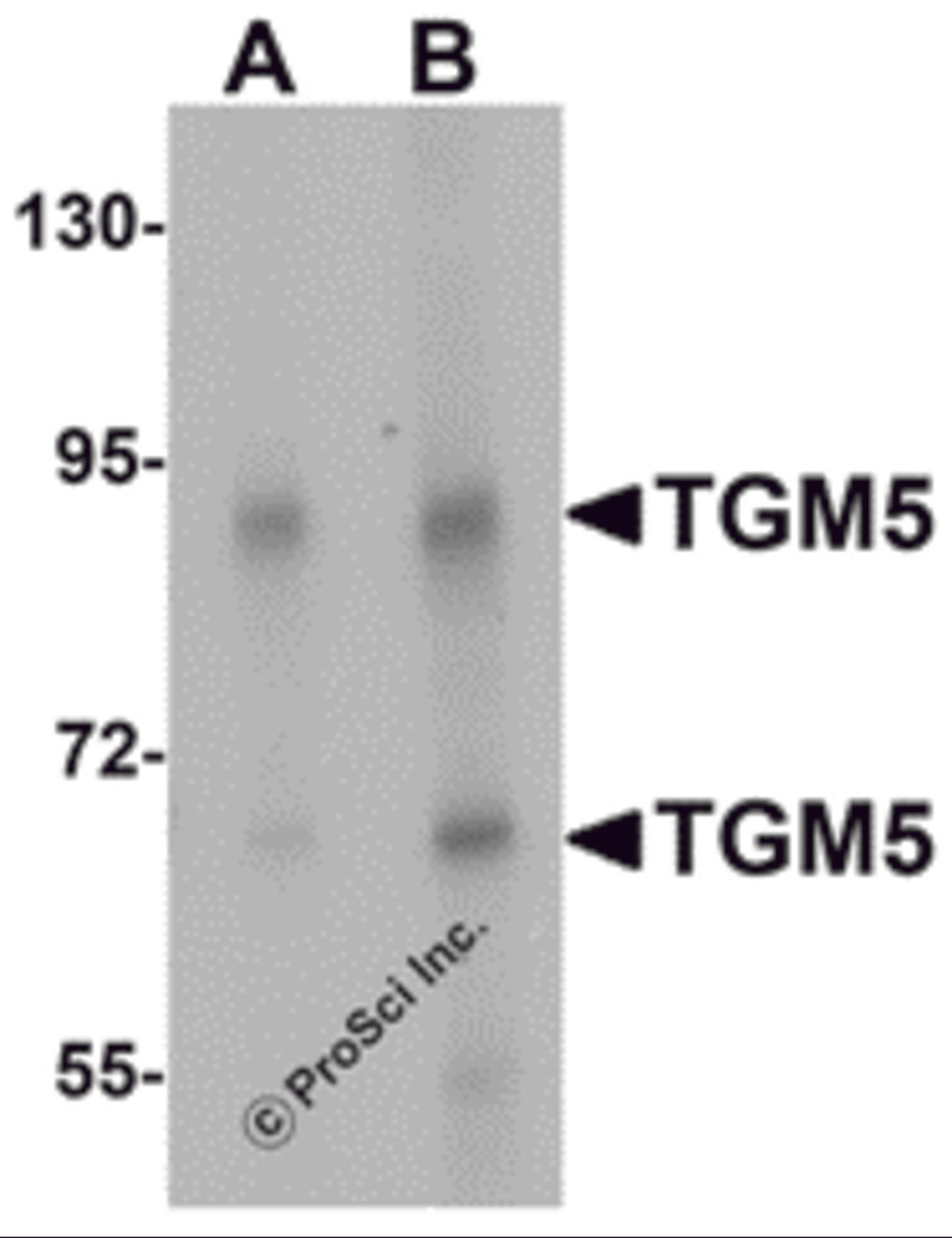 Western blot analysis of TGM5 in rat heart tissue lysate with TGM5 antibody at (A) 1 and (B) 2 μg/mL.