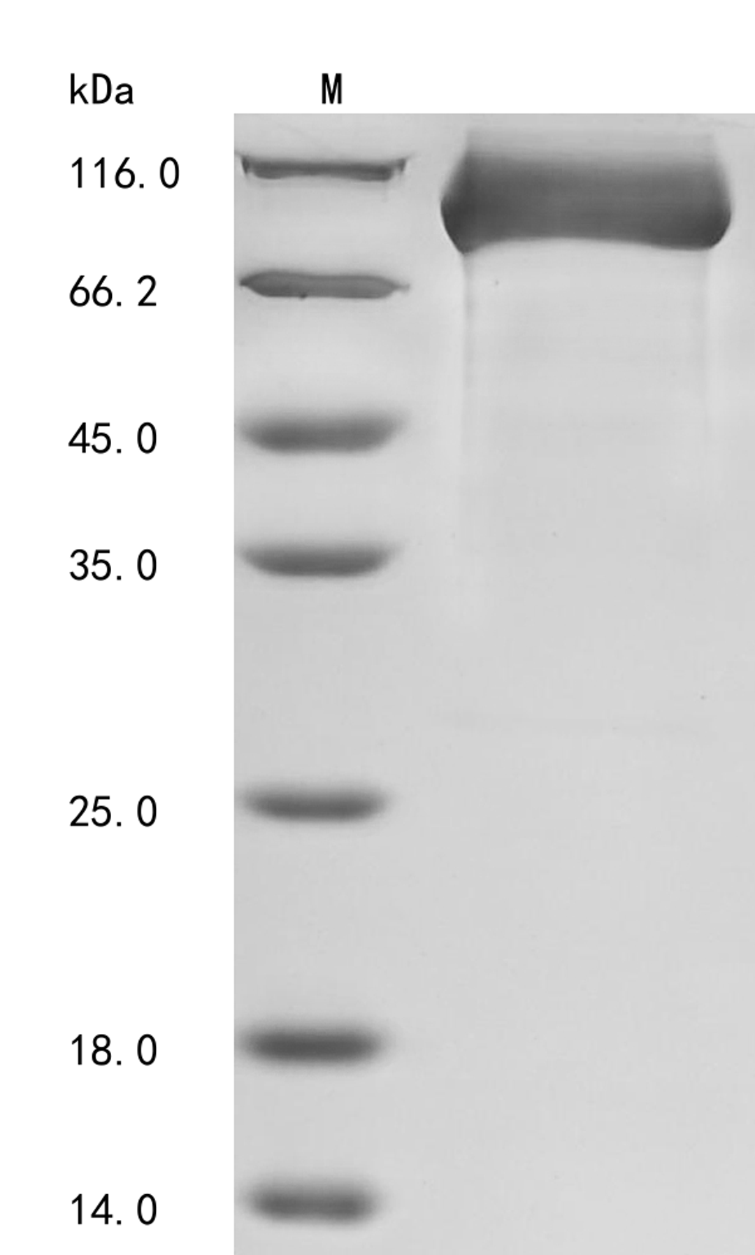 (Tris-Glycine gel) Discontinuous SDS-PAGE (reduced) with 5% enrichment gel and 15% separation gel.