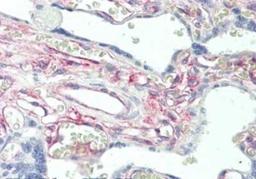 Immunohistochemistry: PRKCDBP Antibody [NBP1-44091] - Tissue: Placenta. Fixation: formalin fixed paraffin embedded. Primary antibody: Anti-Protein Kinase C delta Binding Protein at 5 ug/mL for 1 h at RT. Secondary antibody: Peroxidase rabbit secondary antibody at 1:10,000 for 45 min at RT. Staining: Protein Kinase C delta Binding Protein as precipitated red signal with hematoxylin purple nuclear counterstain.