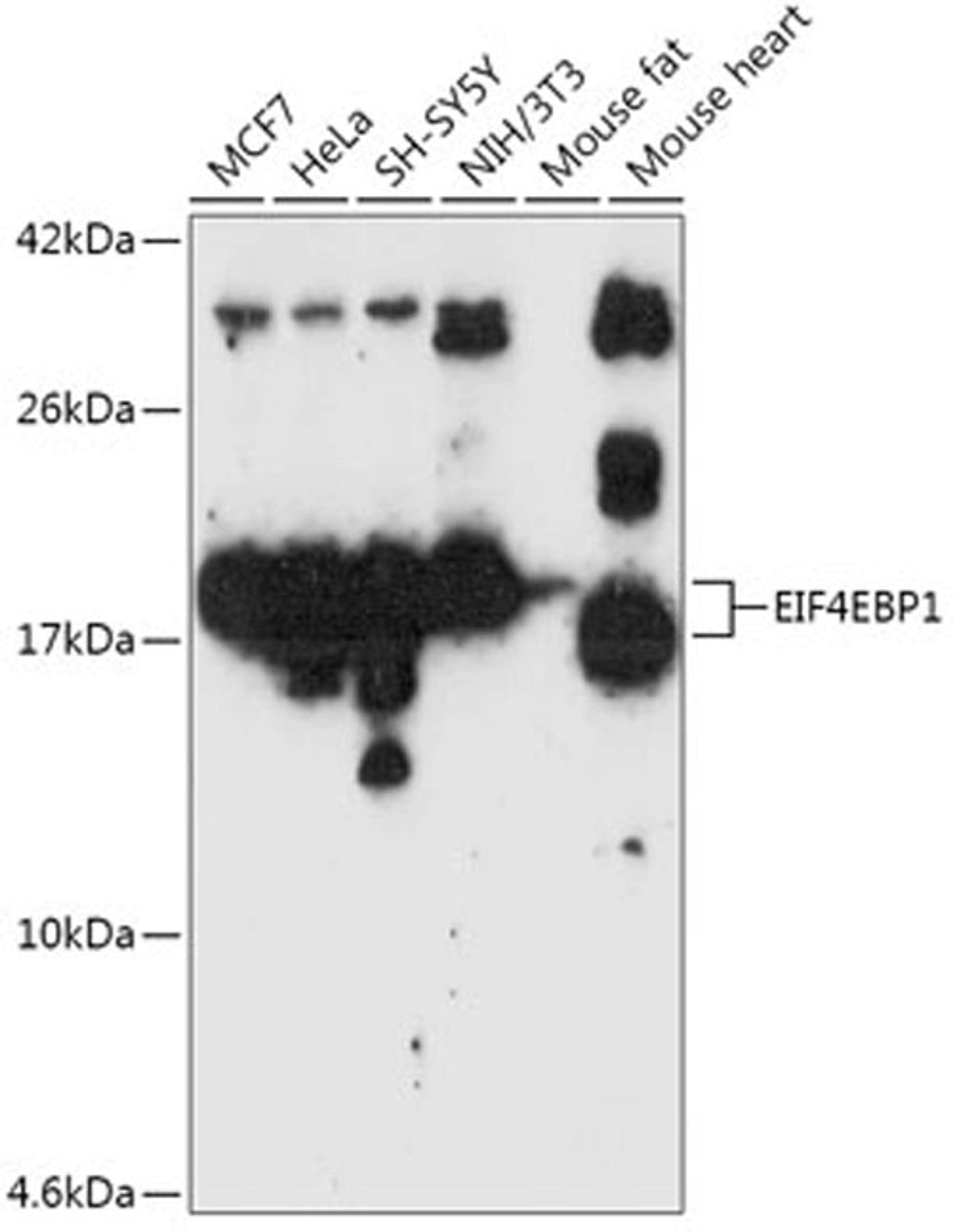 Western blot - EIF4EBP1 antibody (A1248)