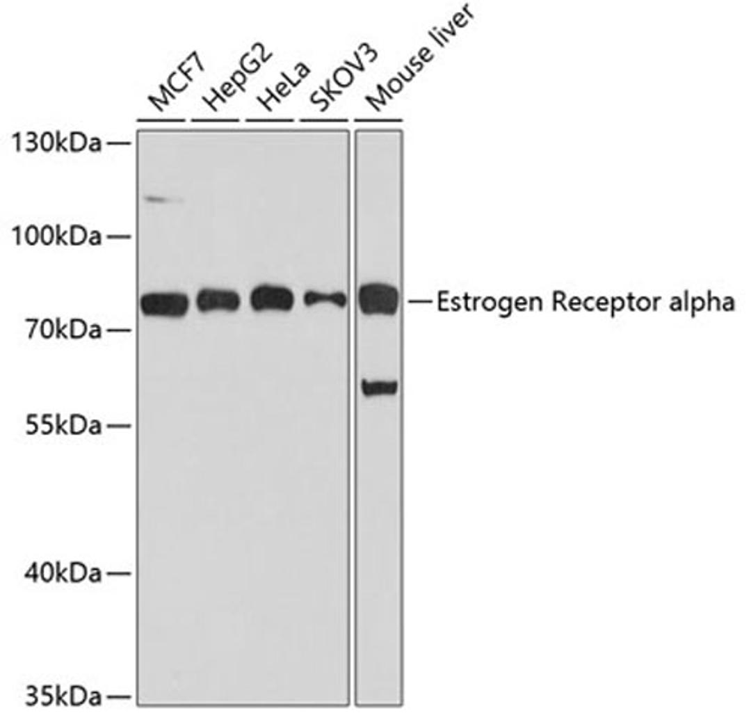 Western blot - Estrogen Receptor alpha antibody (A0296)