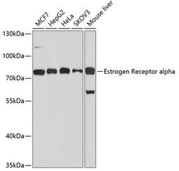 Western blot - Estrogen Receptor alpha antibody (A0296)