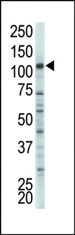 Antibody is used in Western blot to detect HK2 in A375 cell lysate.