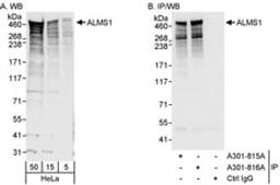 Detection of human ALMS1 by western blot and immunoprecipitation.