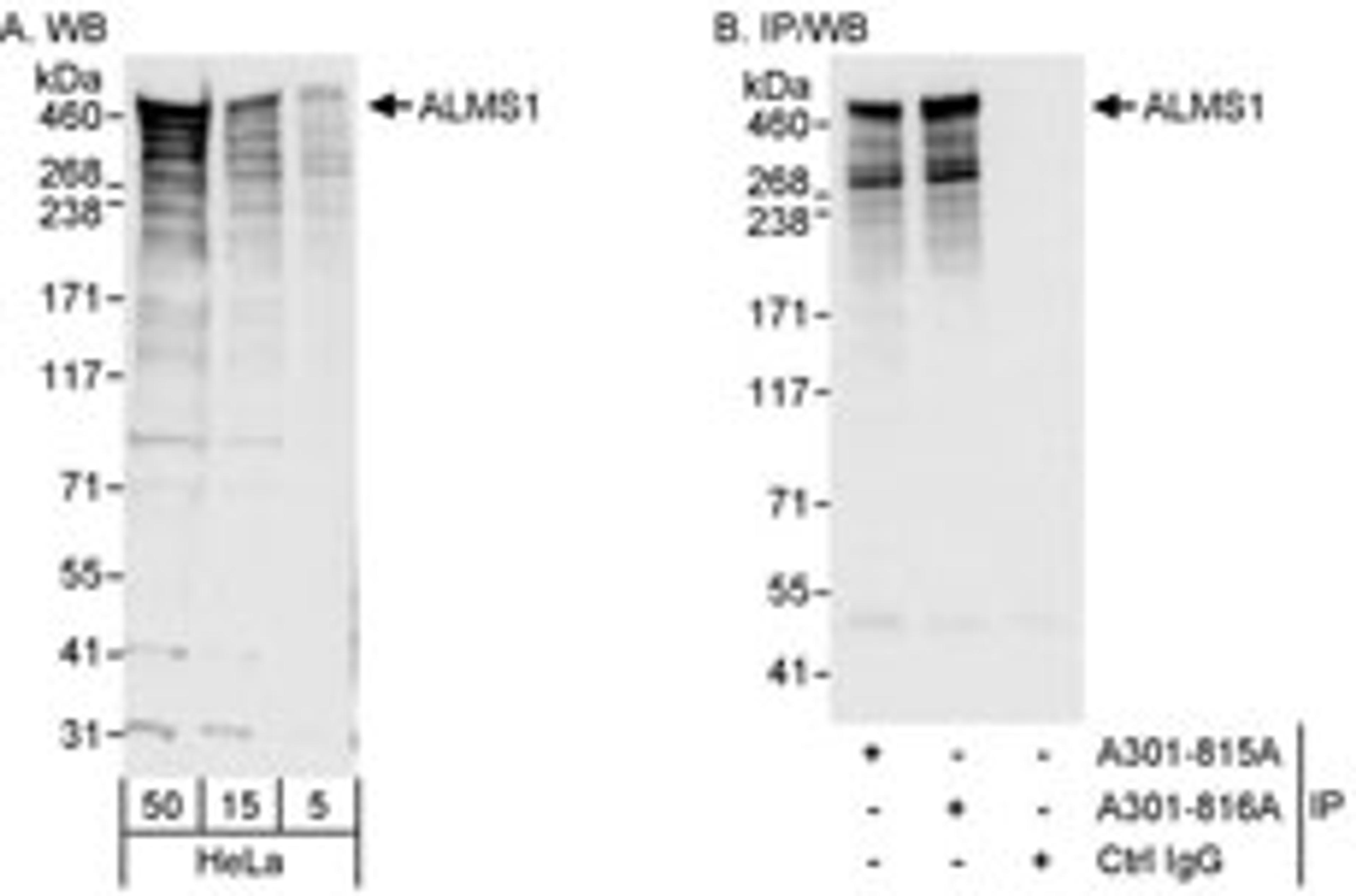 Detection of human ALMS1 by western blot and immunoprecipitation.