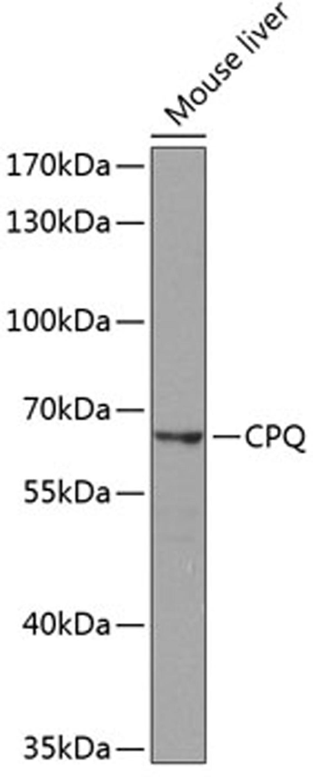 Western blot - CPQ antibody (A8478)